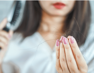 Transplante Capilar Feminino