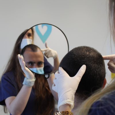 Transplante FUE Transplante FUE