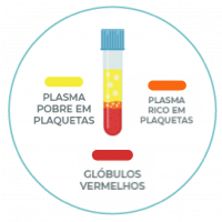 PRP - Extracao do prp PRP - Extracao do prp