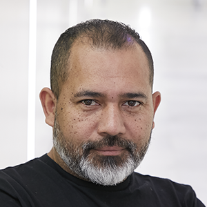 Celso Nascimento - Transplante Capilar