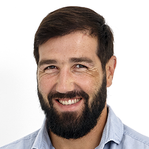 Gonçalo Uva - Transplante Capilar