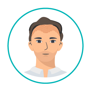 transplante-capilar-icon1 Área transplantada