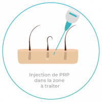 PRP_4-200x200 PRP_4-200x200