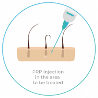 eng-PRP_4-200x200 eng-PRP_4-200x200