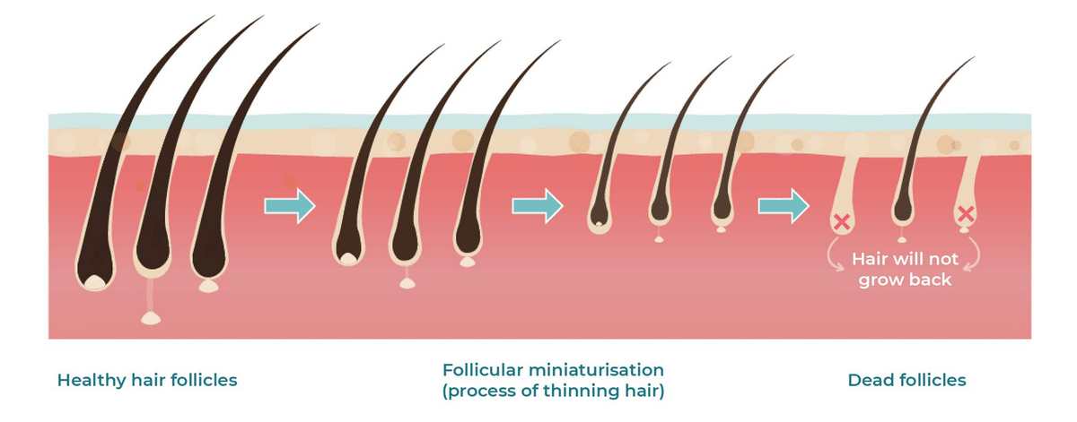 eng-folíciulos_Prancheta-1 (1)