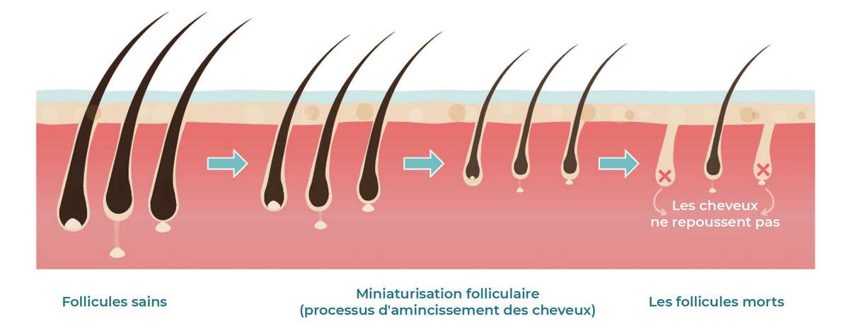 fr-folíciulos_Prancheta-1 (1)-02