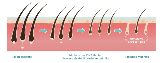 Multimedia_Website_ES_Foliculos