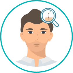 Imagem representativa da quarta fase de como é realizado um transplante capilar – consultas de acompanhamento Imagem representativa da quarta fase de como é realizado um transplante capilar – consultas de acompanhamento