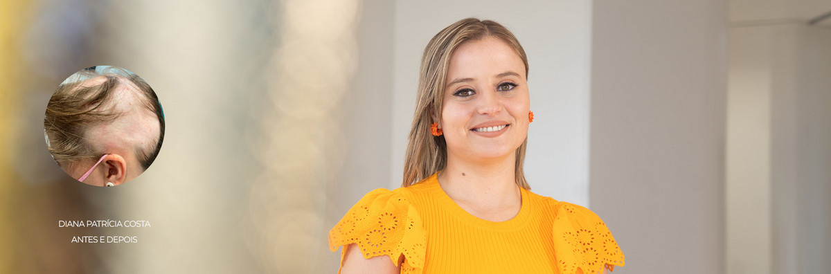 Caso de um antes e depois de uma paciente após ter realizado um tratamento capilar especializado na MediCapilar