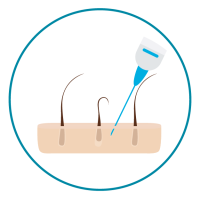 PRP - Injecao PRP - Injecao